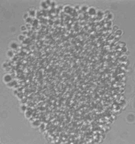 The bacteria inside of the Frankia as seen through an electron microscope. - grid24_12